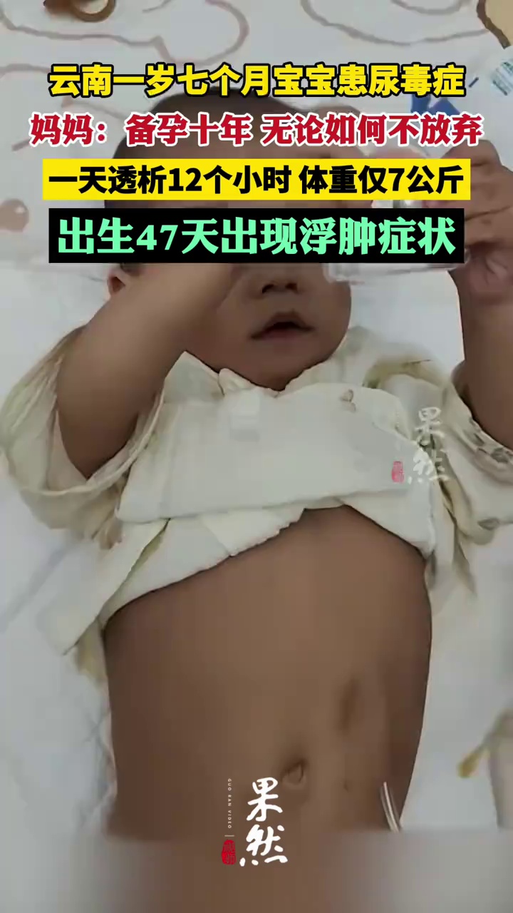女子备孕10年生下宝宝患尿毒症，急需肾移植，每天透析12小时；妈妈：无论如何不放弃（红星新闻）