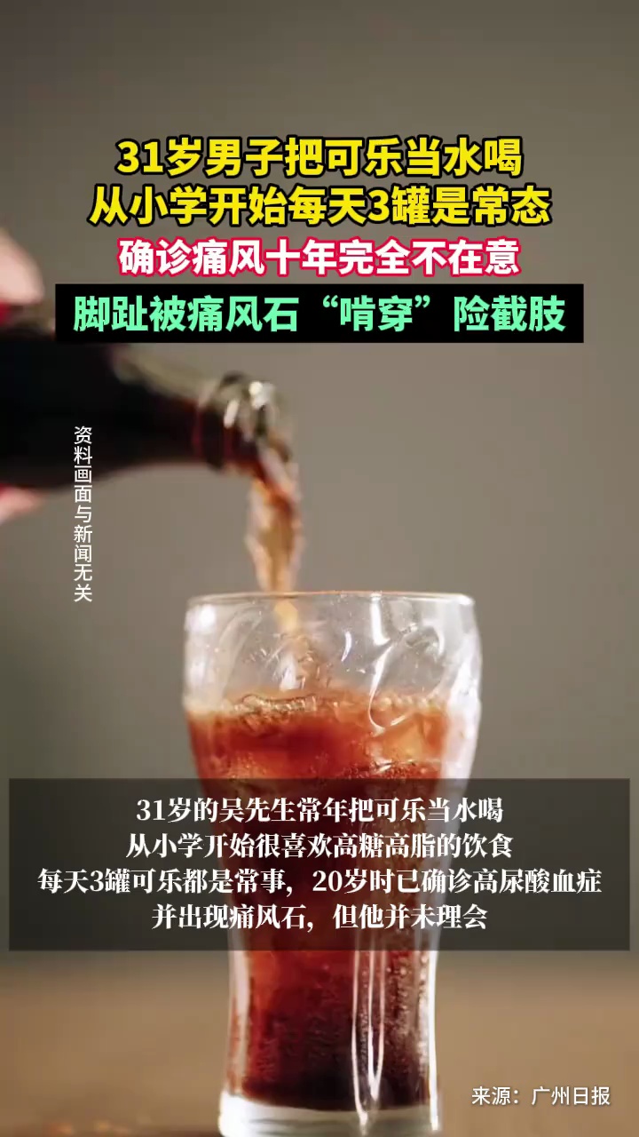 31岁男子把可乐当水喝，确诊痛风十年完全不在意，脚趾被痛风石“啃穿”险截肢