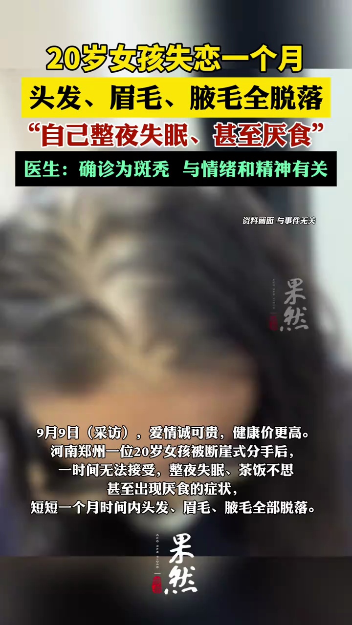 20岁女孩失恋一个月，头发、眉毛、腋毛全部脱落。（大参考）