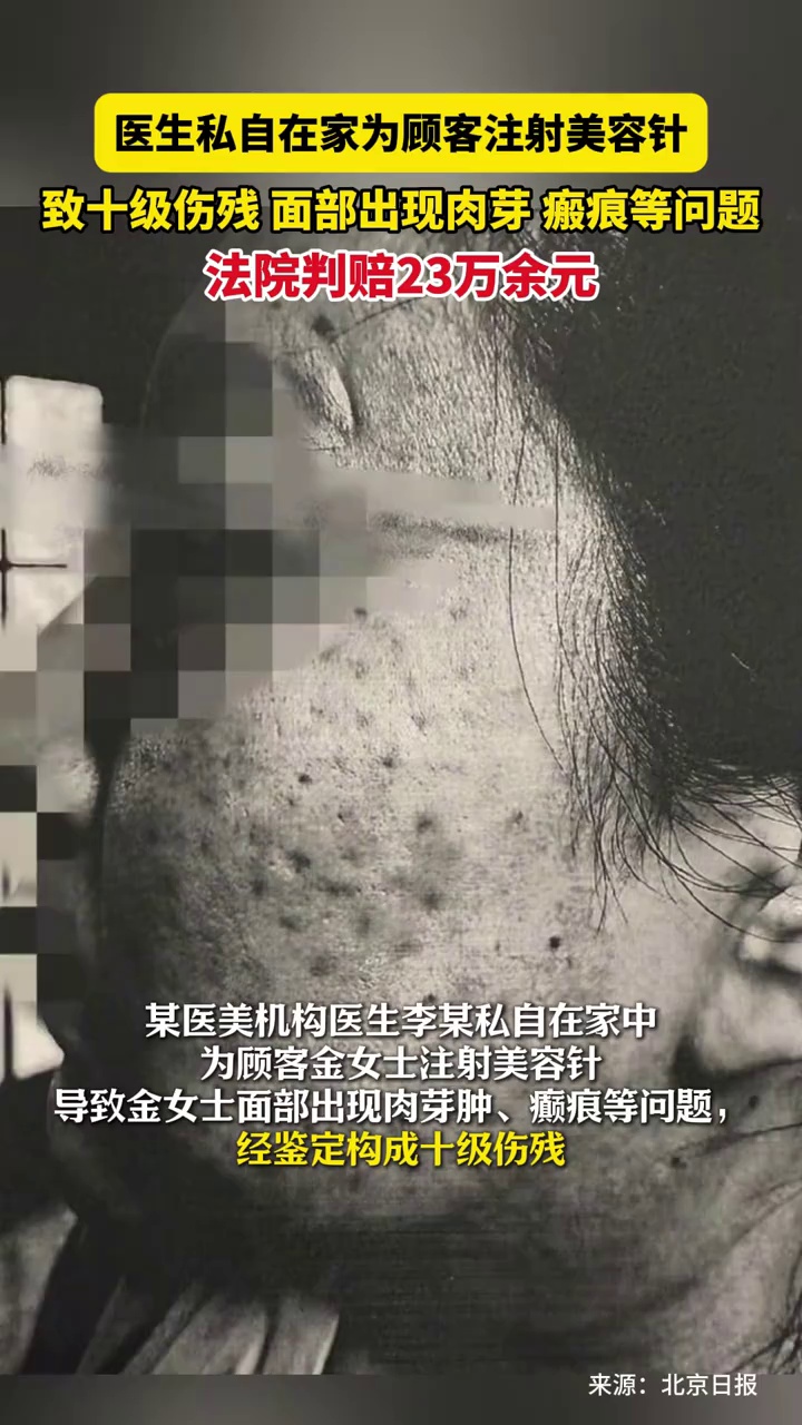 医生私自在家为顾客注射美容针，致十级伤残，法院判赔23万余元
