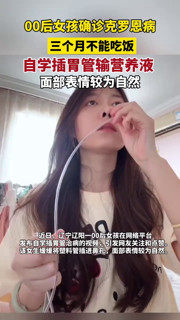 术后不能吃饭00后女孩自学插胃管（极目新闻）