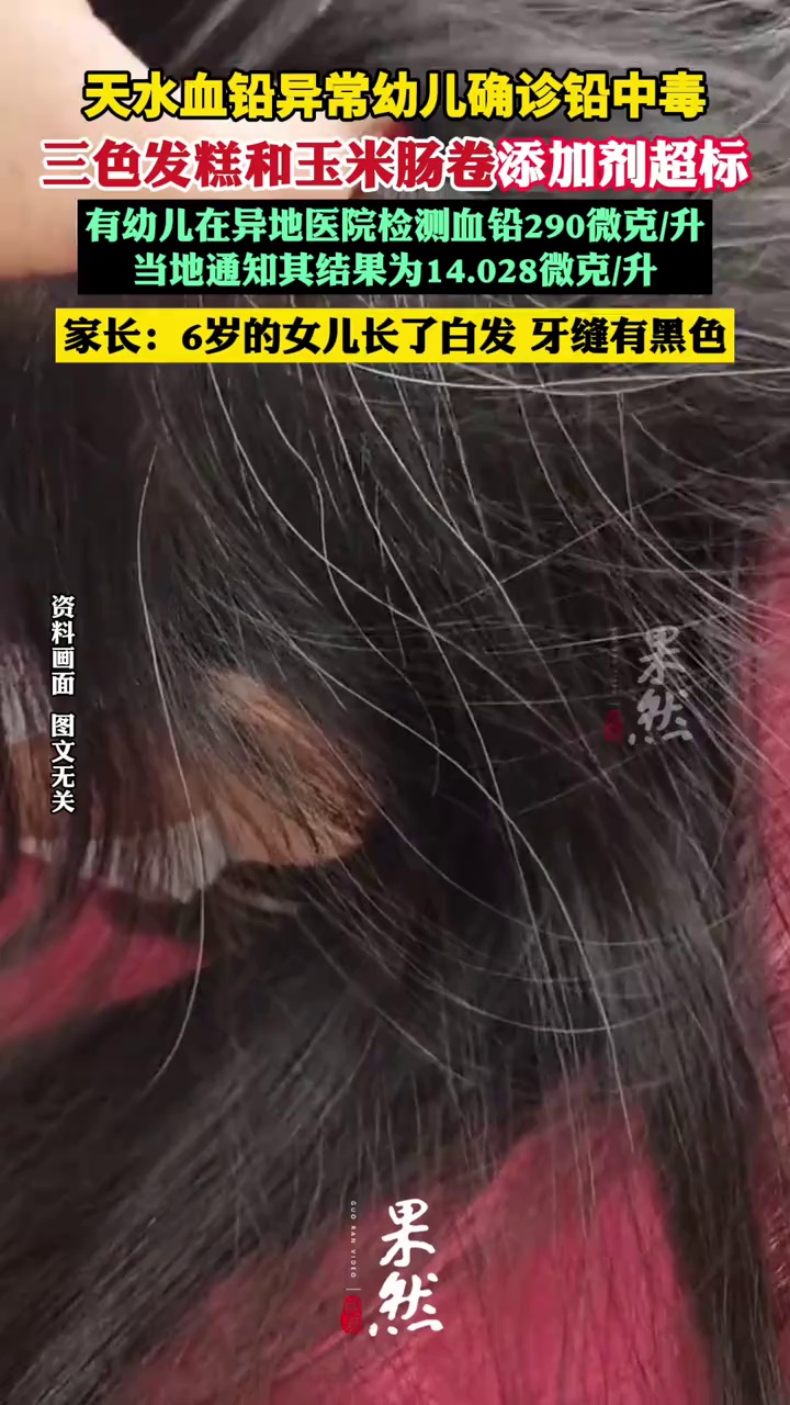 天水血铅异常幼儿确诊铅中毒，疑似“毒源”浮出水面：抽检的三色发糕和玉米肠卷添加剂超标（红星新闻 极目新闻）