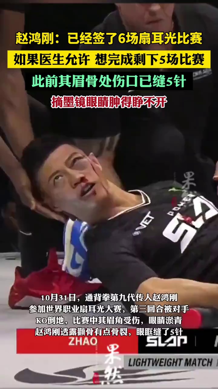 赵鸿刚：已经签了6场扇耳光比赛，如果医生允许，想完成剩下5场比赛