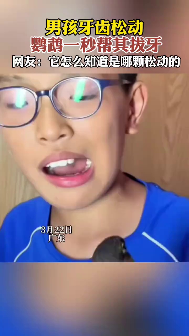 男孩牙齿松动，鹦鹉一秒帮其拔牙 网友：它怎么知道是哪颗牙的？