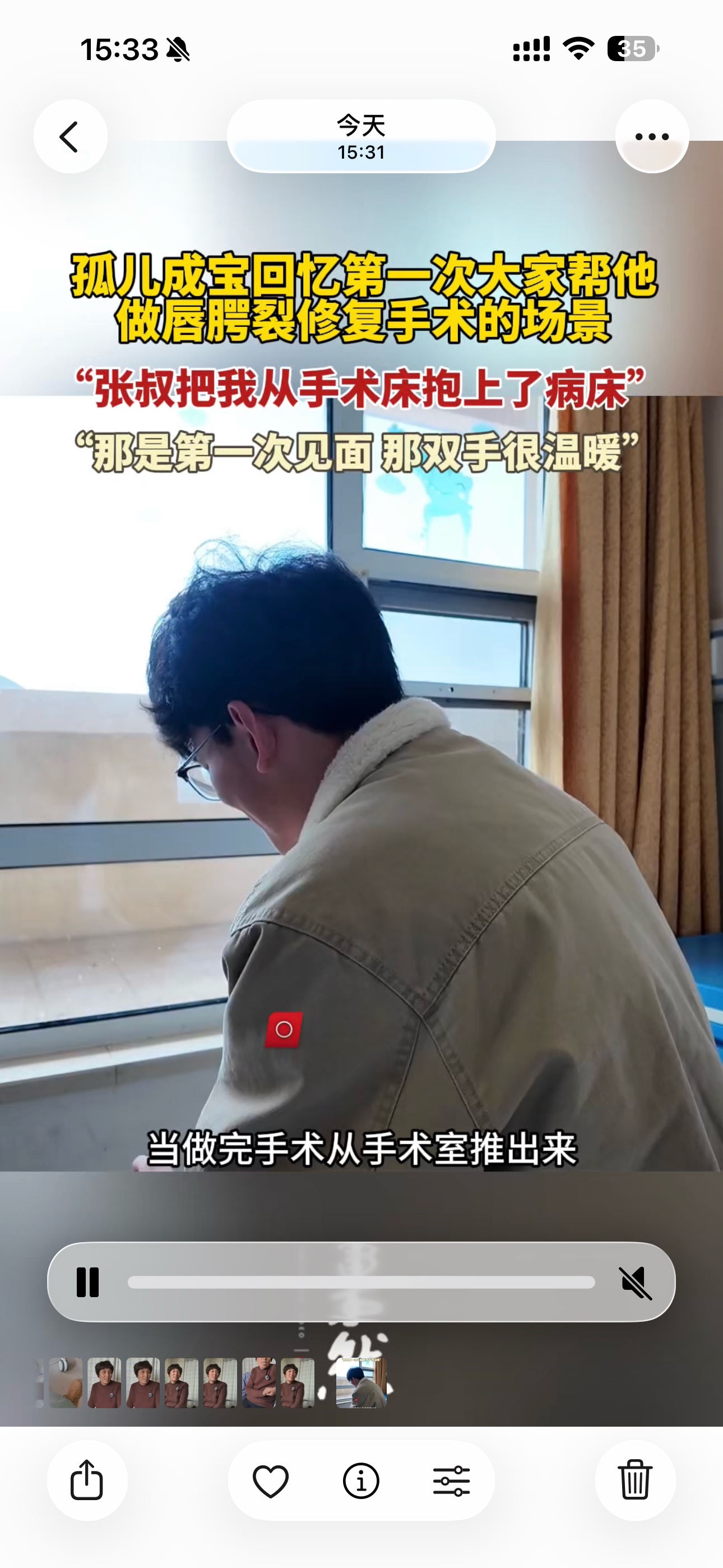 果然视频｜“抱我的手很温暖”！成宝回忆第一次唇腭裂修复手术