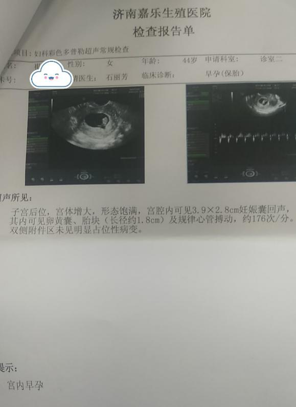 怀孕彩超报告单图片图片